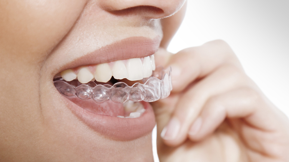 retirar retenedor transparente